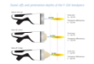 Obrázok z INTELECT FOCAL SHOCKWAVE SET - CHATTANOOGA